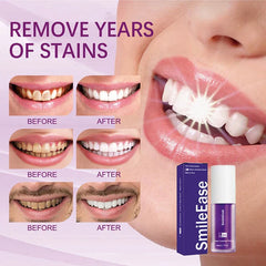 Hi-Smile Teeth whitening Paste - Limited Stock